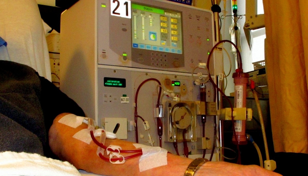 Dialysis - arm - 01